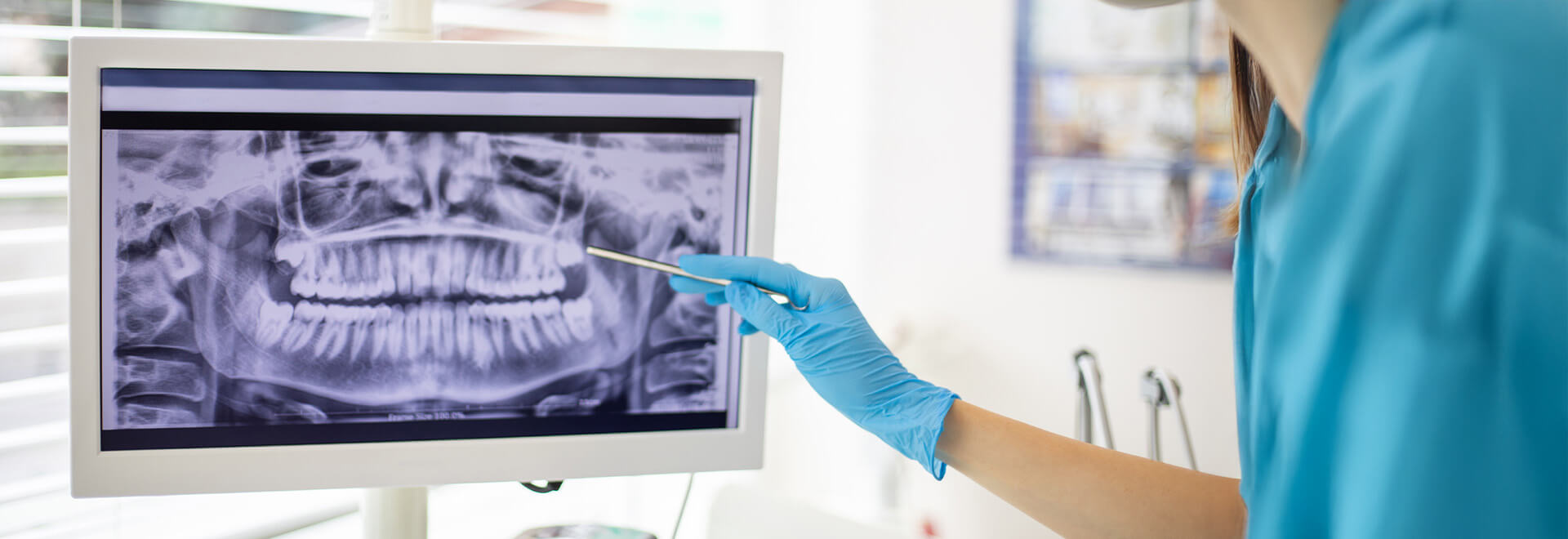 xrays